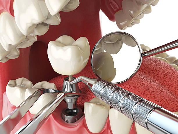 Best Pediatric Emergency Dentist in Fairfax, VA