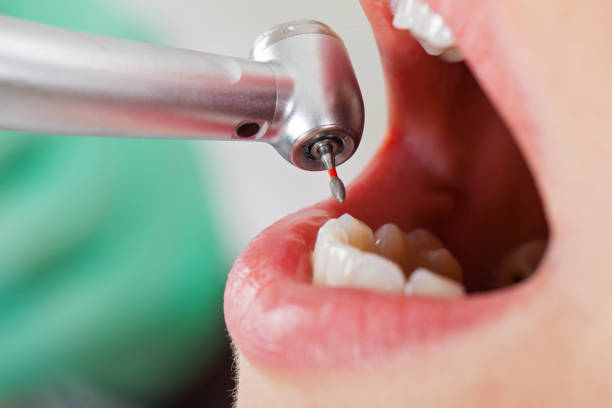 Best After-Hours Emergency Dentist in Fairfax, VA